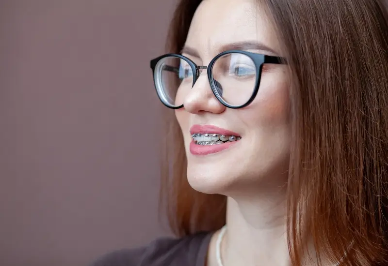 A woman smiles with traditional braces in Parker, CO